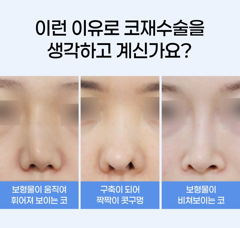 Rhinoplasty Revision: Analysis of Causes by Type Before Proceeding