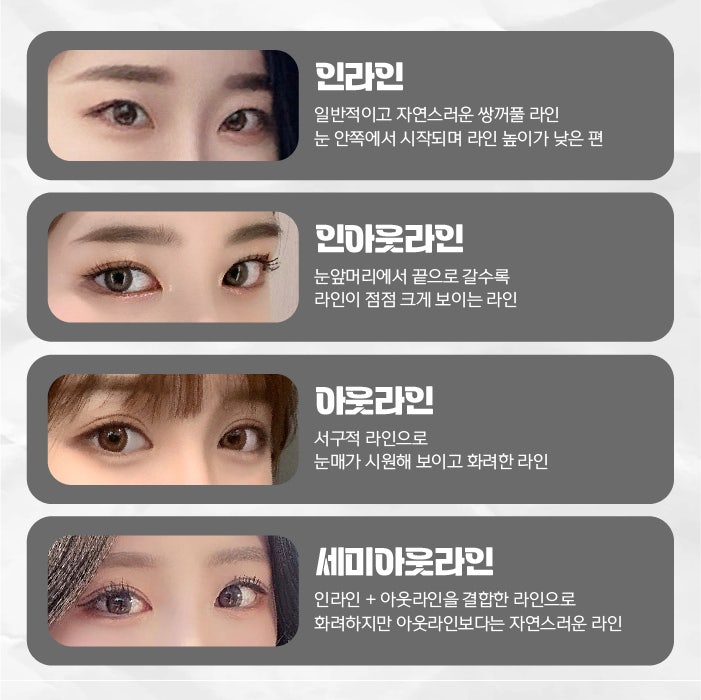 Busan Eye Surgery: Which Method is Right for Me?