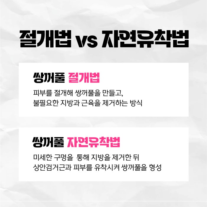 Busan Eye Surgery: Which Method is Right for Me?