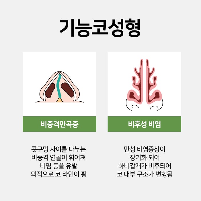 Busan Functional Rhinoplasty: Considering Function, Aesthetics, and Individual Condition