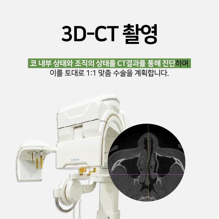 Busan Functional Rhinoplasty: Considering Function, Aesthetics, and Individual Condition