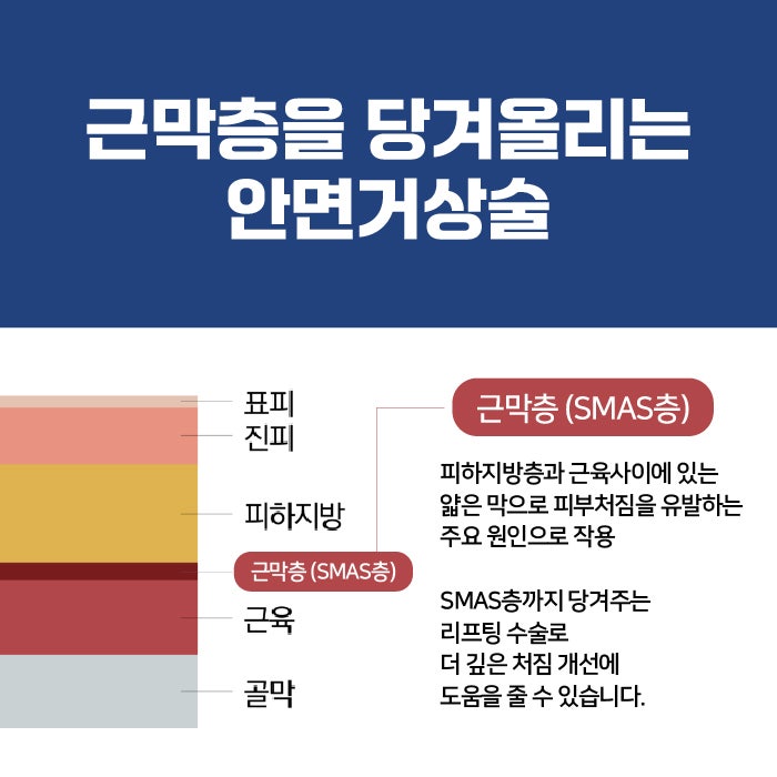 Various Types and Surgical Methods of Busan Lifting