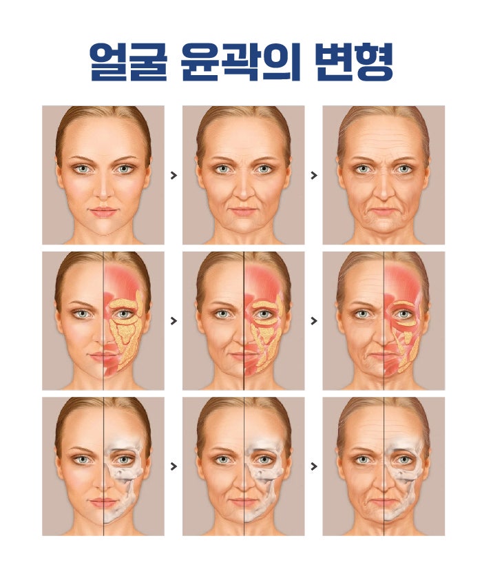 Various Types and Surgical Methods of Busan Lifting