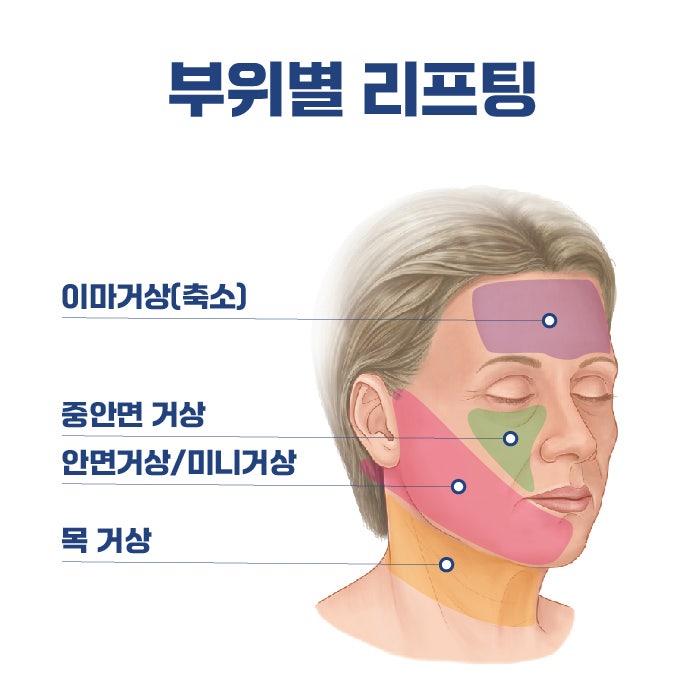 Various Types and Surgical Methods of Busan Lifting