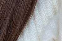 Сомён Минт утасны өргөлт: Хацрын үрчлээ, унжсан хацарт уян хатан байдал