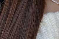 Сомён Минт утасны өргөлт: Хацрын үрчлээ, унжсан хацарт уян хатан байдал