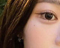 Why is Seomyeon Eye Revision Surgery More Difficult and Requires Greater Caution?
