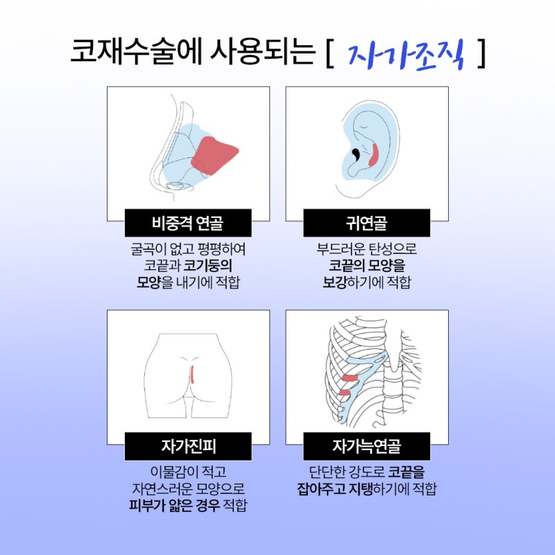 Seomyeon Revision Rhinoplasty: Finding the Right Implant for Your Nose