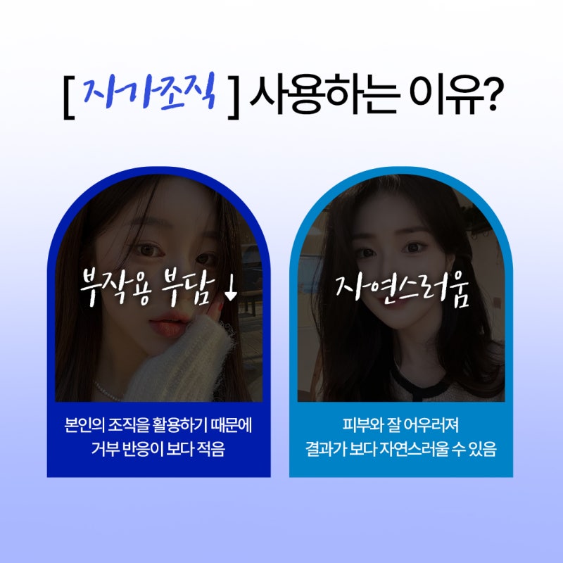 Seomyeon Revision Rhinoplasty: Finding the Right Implant for Your Nose