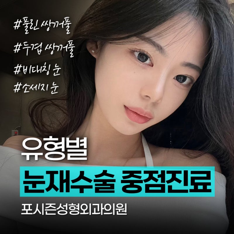 Нүдний давтан мэс заслыг дахин авч үзэх цаг хугацаа ба гол шалгуур үзүүлэлтүүд