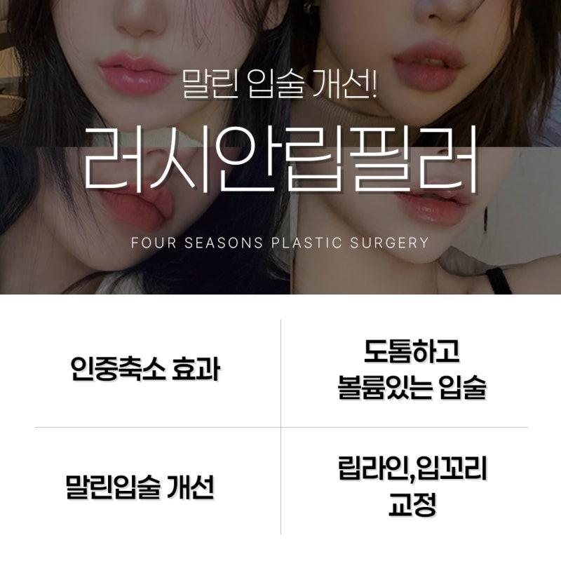 Busan Russian Lip Filler: Lip Filler with Philtrum Reduction Effect