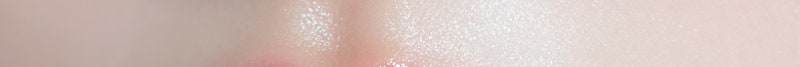 Busan Russian Lip Filler: Lip Filler with Philtrum Reduction Effect