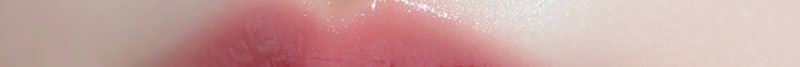 Busan Russian Lip Filler: Lip Filler with Philtrum Reduction Effect