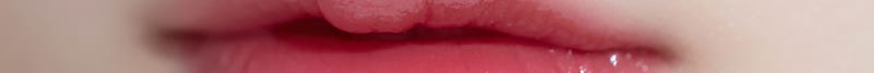 Busan Russian Lip Filler: Lip Filler with Philtrum Reduction Effect