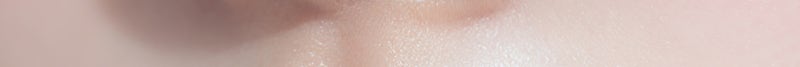 Busan Russian Lip Filler: Lip Filler with Philtrum Reduction Effect