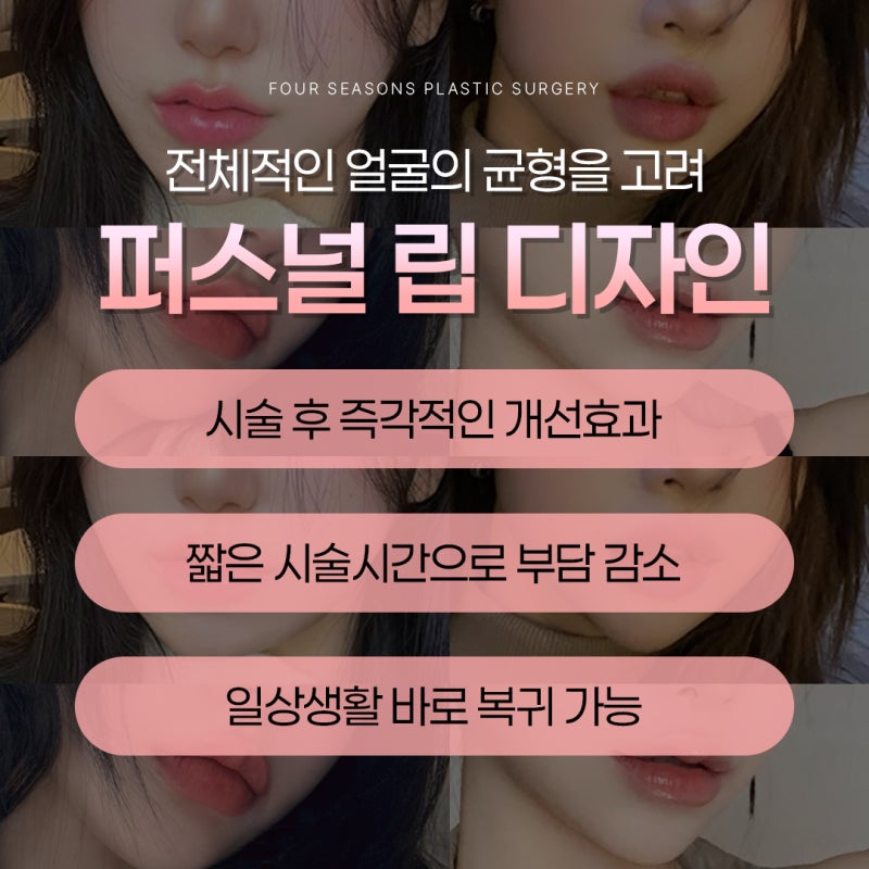 Busan Russian Lip Filler: Lip Filler with Philtrum Reduction Effect