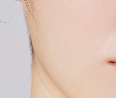 Busan Neck Wrinkle Treatment: The Start of Managing Neck Wrinkles That Make You Look Older Than Your Age
