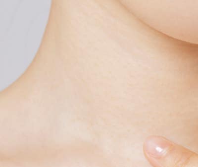 Busan Neck Wrinkle Treatment: The Start of Managing Neck Wrinkles That Make You Look Older Than Your Age