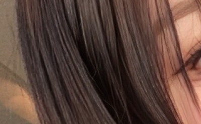 تصغير الشفة العلوية في سيو ميون: تغيير نسبة الوجه من خلال جراحة تصغير الشفة العلوية