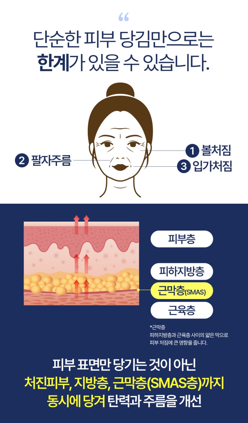 มินิลิฟติ้งปูซาน มินิเฟซลิฟต์ที่ลดภาระเรื่องรอยแผลเป็น