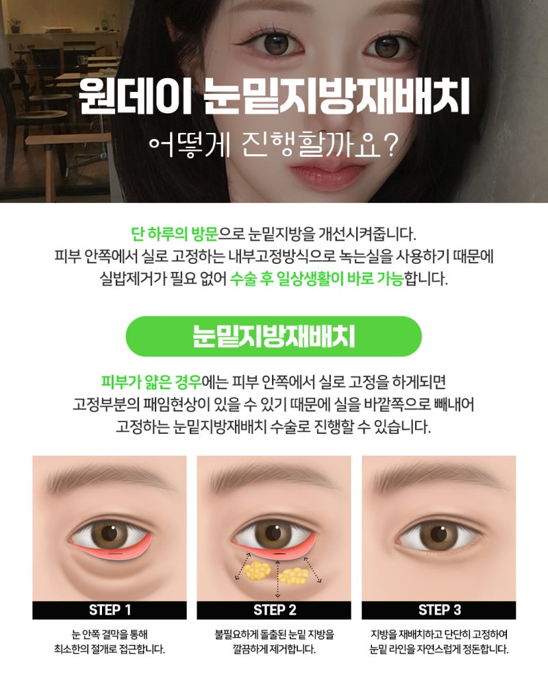 การจัดเรียงไขมันใต้ตาใหม่เพื่อปรับปรุงใต้ตาที่หย่อนคล้อยและหมองคล้ำ