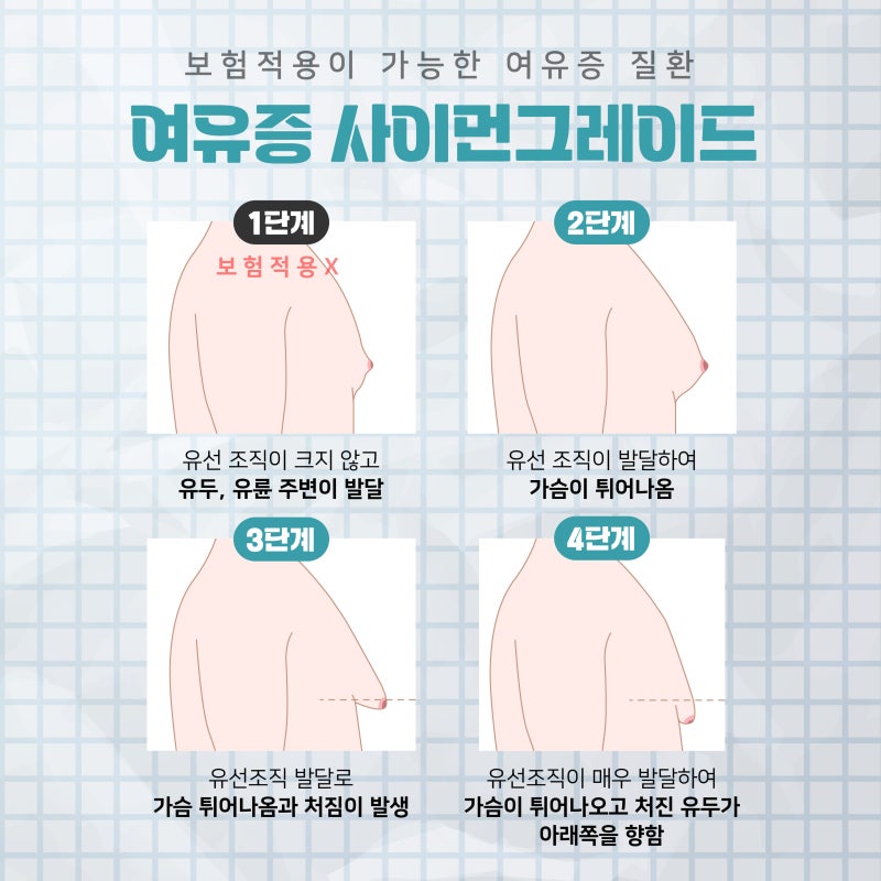 การผ่าตัดแก้ไขภาวะหน้าอกโตในผู้ชายที่ปูซาน: ตั้งแต่สาเหตุจนถึงการรักษา
