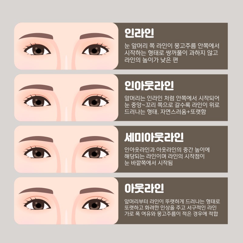 What are the key factors determining the outcome of eye surgery?