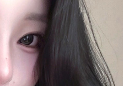 What are the key factors determining the outcome of eye surgery?