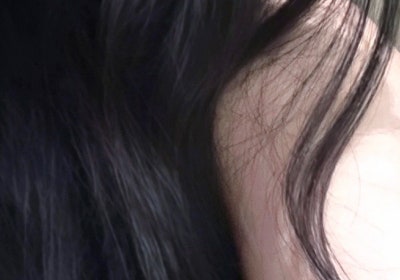 What are the key factors determining the outcome of eye surgery?