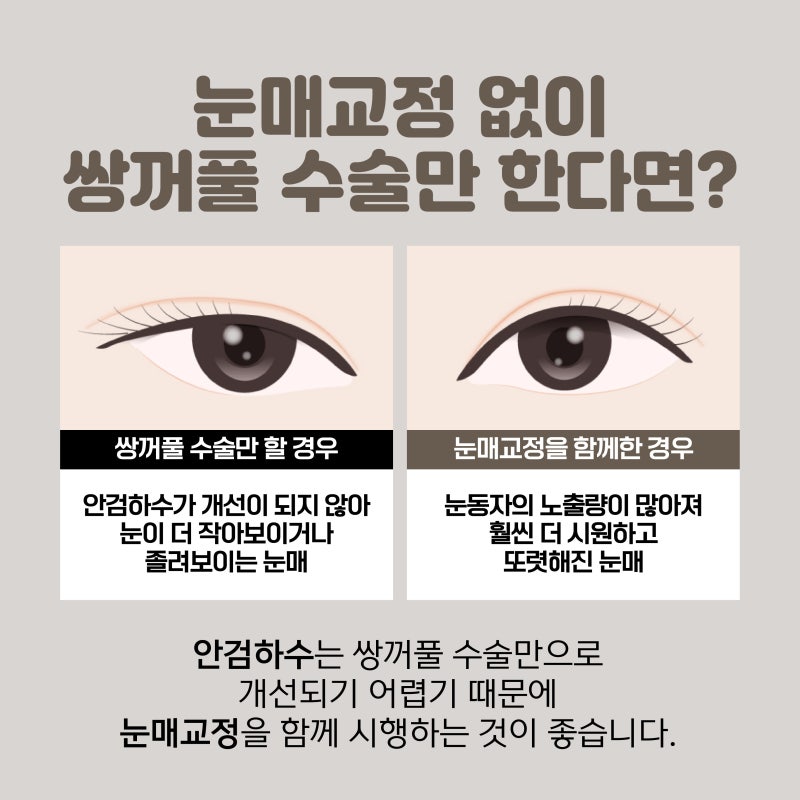 What are the key factors determining the outcome of eye surgery?