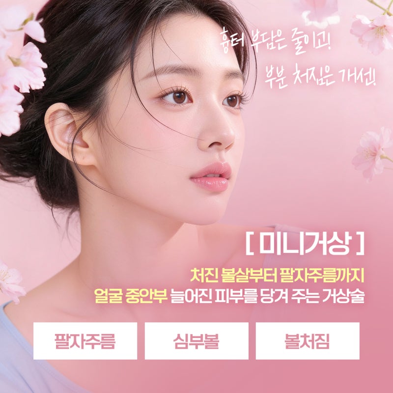 Mid-Face Sagging Improvement with Mini Facelift for Nasolabial Folds in Seomyeon
