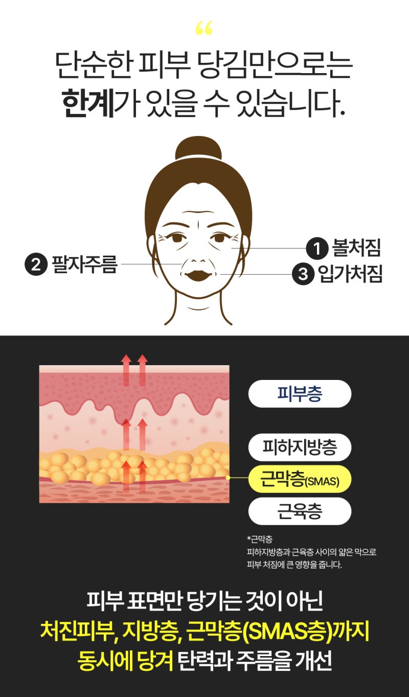 หากกังวลเรื่องรอยแผลเป็นจากการยกกระชับใบหน้าแบบซอ-มยอน ลองพิจารณาการยกกระชับใบหน้าแบบมินิเฟซลิฟต์
