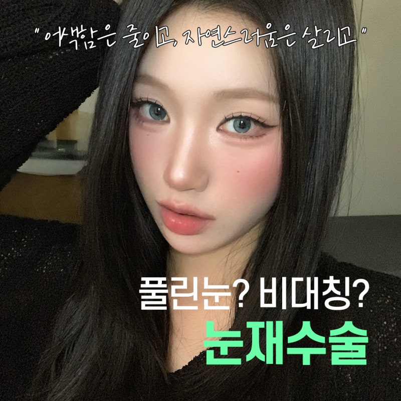Customized Double Eyelid Revision Surgery Based on Individual Eye Analysis