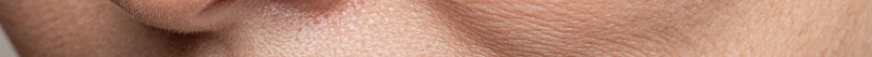 Busan Eyebrow Lift: The Choice for Improving Tired Eyes