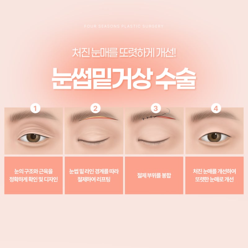 Busan Eyebrow Lift: The Choice for Improving Tired Eyes