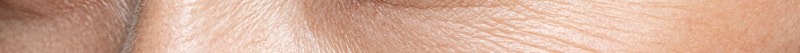 Busan Eyebrow Lift: The Choice for Improving Tired Eyes