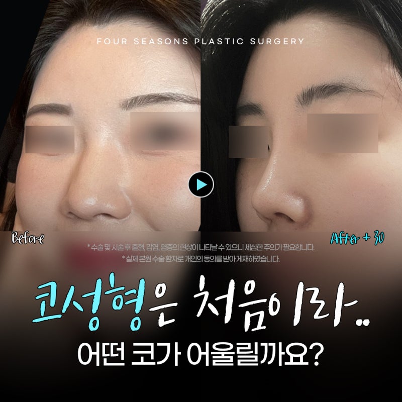 ศัลยกรรมจมูกที่ปูซานครั้งแรก ควรทำจมูกแบบไหนดี?