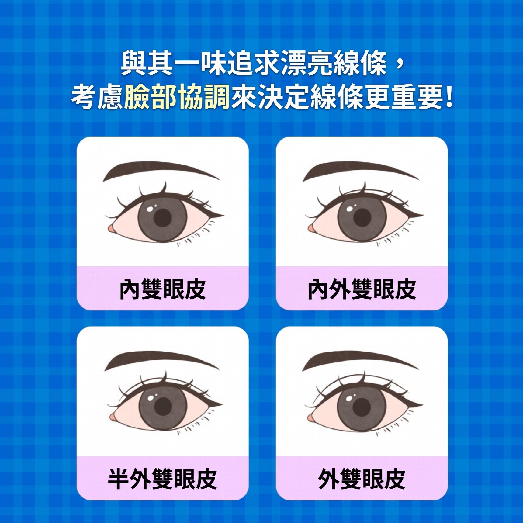 西面雙眼皮手術做得好的地方 雙眼皮手術與上眼瞼手術有何不同?