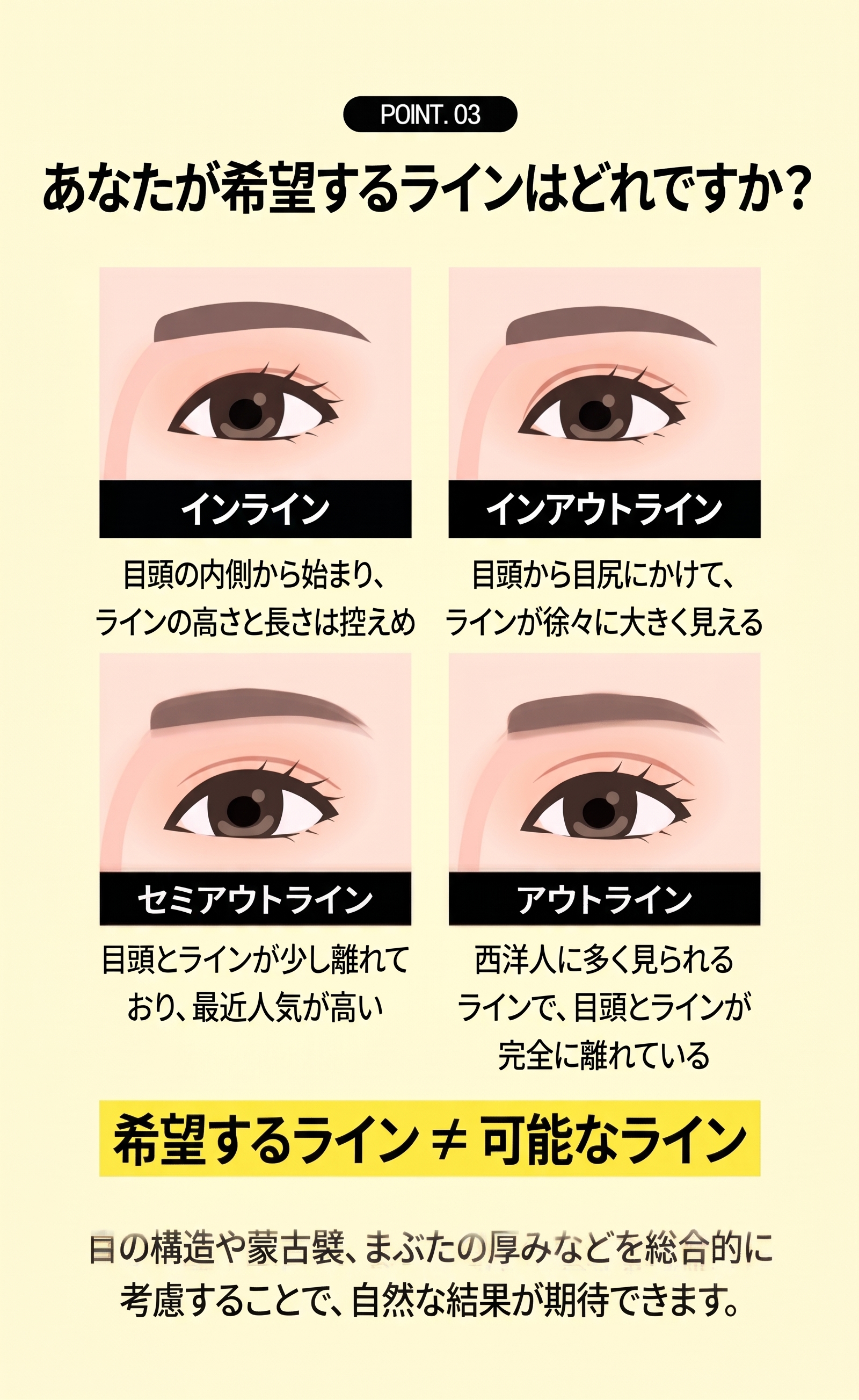 釜山二重まぶた整形、自分の目に合った手術法を見つける方法