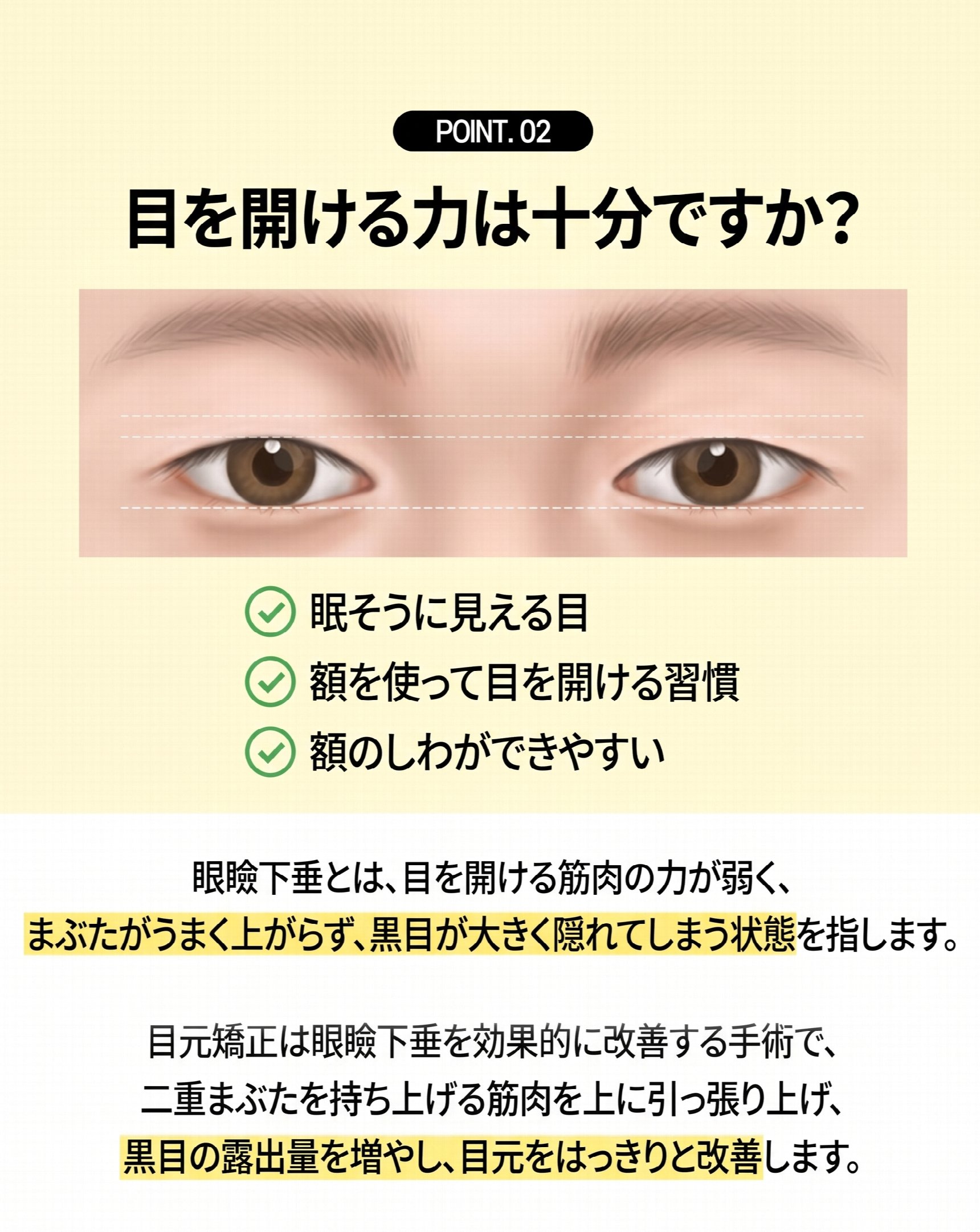 釜山二重まぶた整形、自分の目に合った手術法を見つける方法