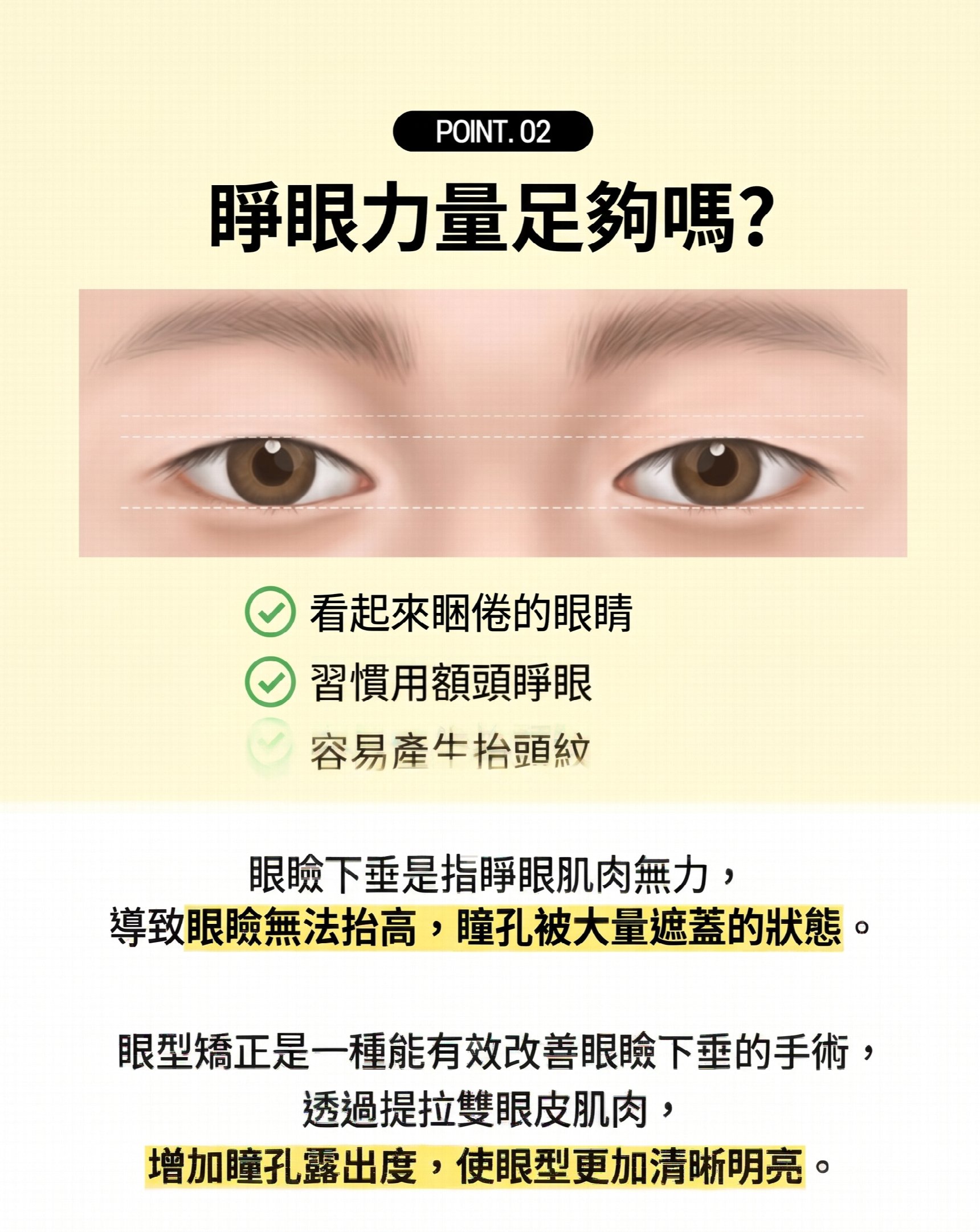 釜山眼部整形，如何找到適合自己的手術方法