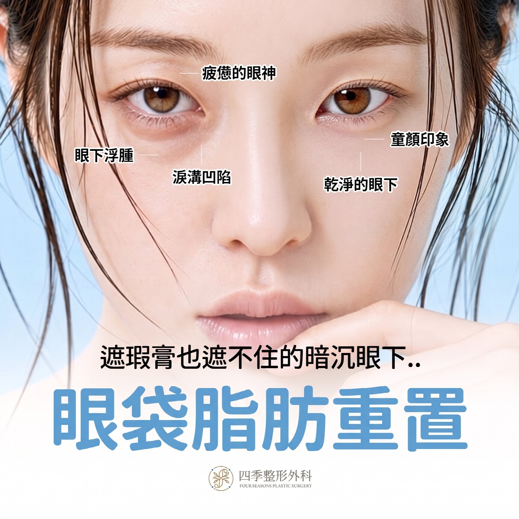眼底脂肪重新排列，一次改善黑眼圈和眼底浮腫