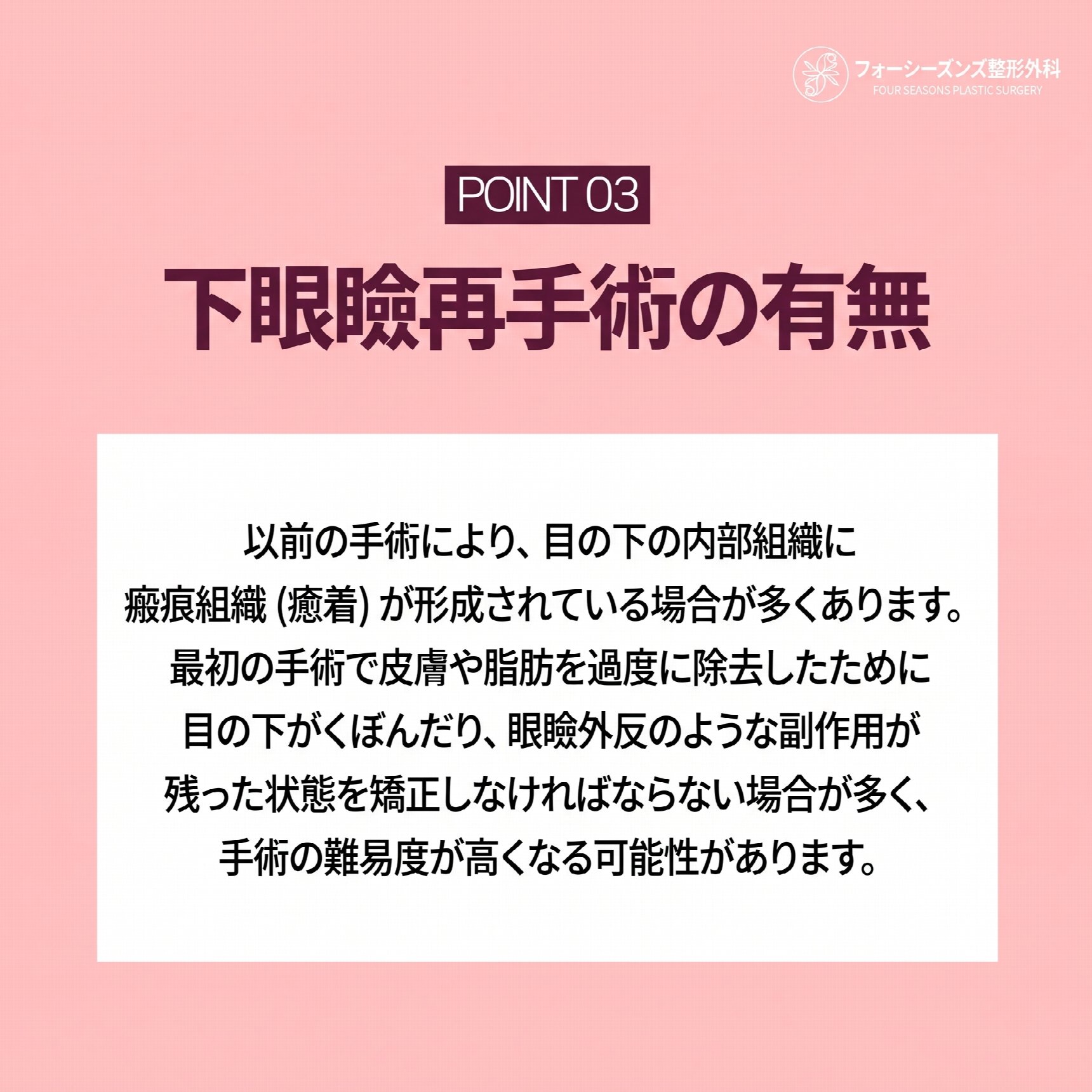 西面下眼瞼手術 費用が異なる理由とは?
