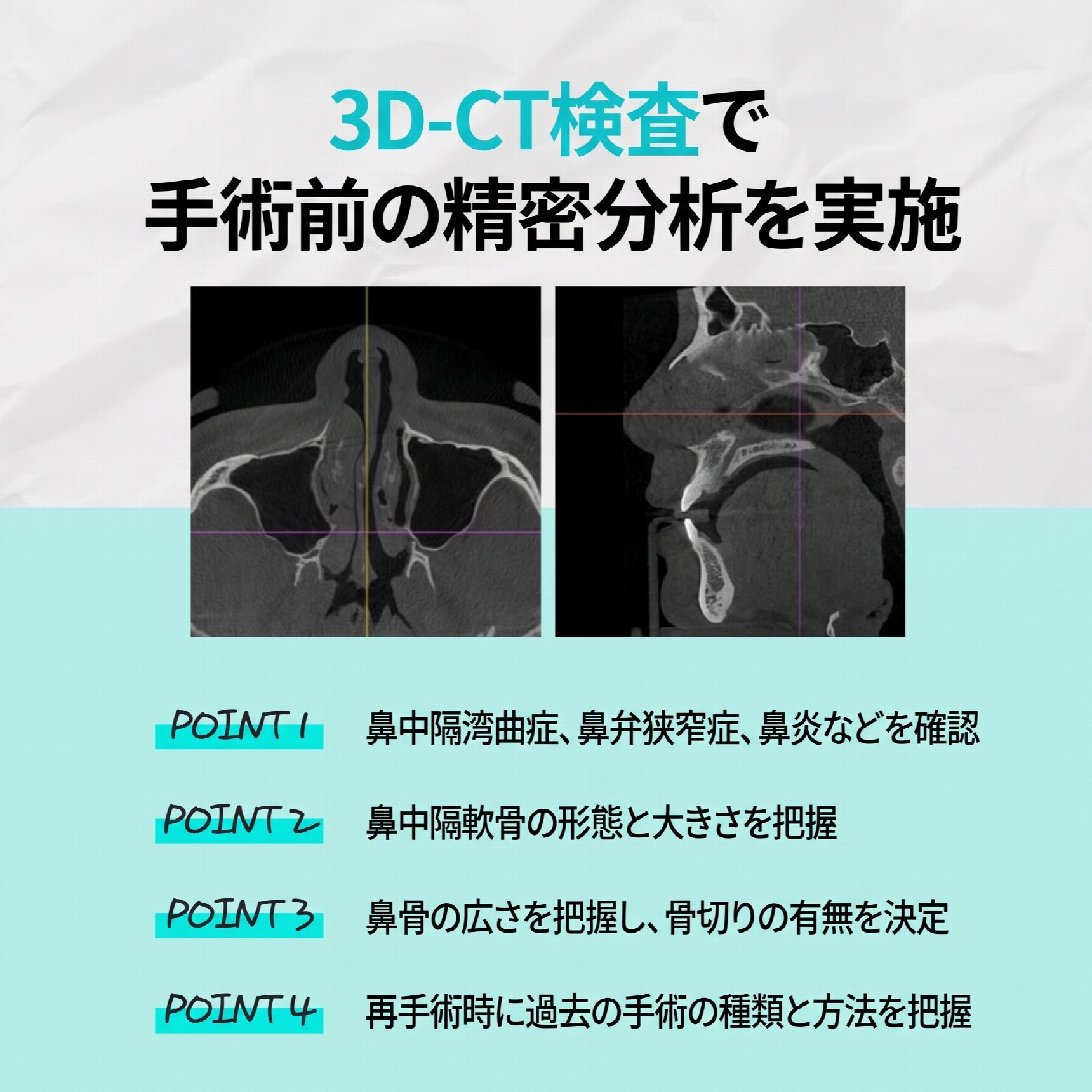 釜山機能性鼻整形：構造的鼻炎と外見の改善を同時に