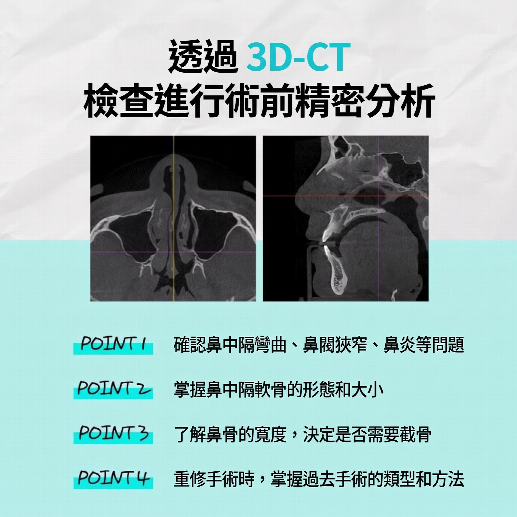 釜山功能性鼻整形:同時改善結構性鼻炎與外觀問題