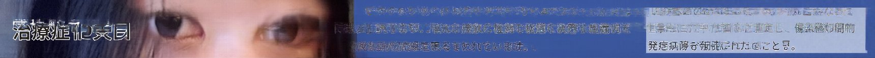 西面（ソミョン）二重再手術 自分に似合う目元を再設計するプロセスとは