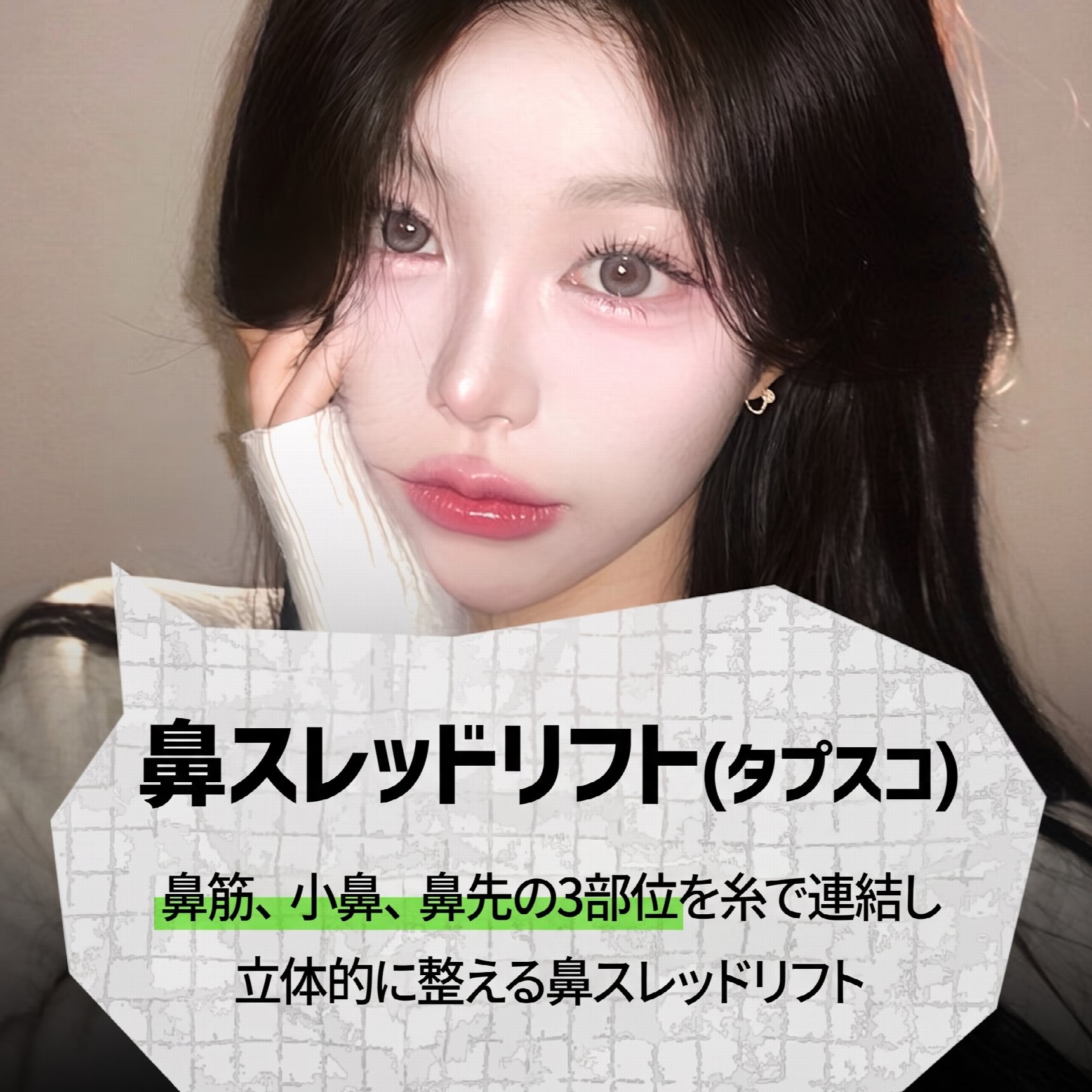 釜山鼻スレッドリフト：切開なしで鼻筋や小鼻を改善できる？