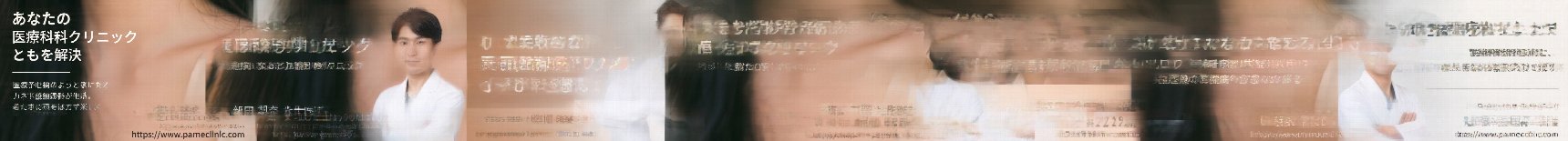 釜山鼻スレッドリフト：切開なしで鼻筋や小鼻を改善できる？