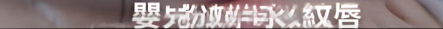 釜山水光針 從乾燥到細紋都能改善的保柔緹 Belotero Revive