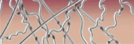رسم توضيحي للطبقة العميقة من الأدمة قبل الإجراء، حيث الألياف متفرقة وغير كثيفة